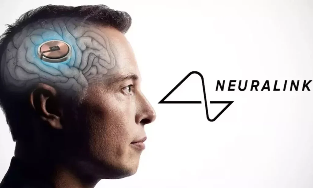 Neuralink Har Opererat In Chip i Människa För Första Gången
